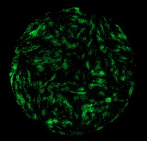 SVE; CMV-Gr-copie-4b885efbb0970be80881ba9f5c1e482e