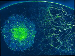 SVE; Communication-nerfs-tumeur-5607c15a65787a70e344dc2de71ec69a