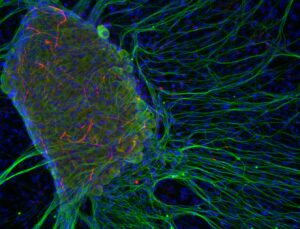 SVE; Cultures-de-nerfs-CThibert-e89832b2ce9c94cf384875275948766a