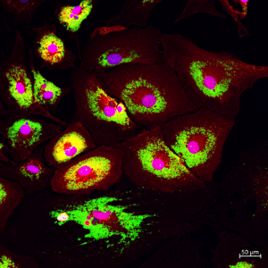 SVE; FAPS-in-proliferation-e8f0641b05f9101fc535f3a12f6dc8de
