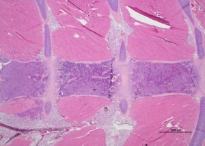 SVE; FS_lea-goupille_Sternum–8b3badba799411a405b565f909386e6f