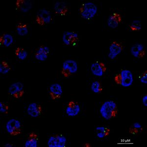 SVE; FS_lea-goupille_microscopie-91be91b9e256adf670f3b9798449c089