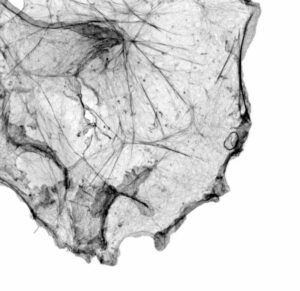 SVE; SBCF_Mariacristina-CAPIZZI_Reseau-etoile-deb53b2671ca1b32a7ea110754f8b6d0