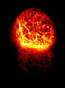 SVE; SBCF_Remi-CARPENTIER_meduse-de-feu-c2e5fcb79f8a407704530fa096495bdb