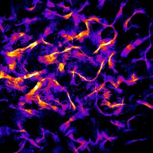 SVE; SBCF_Remi-CARPENTIER_papillons-dactine-4847d2bdd04a5b08b8f7515350533649