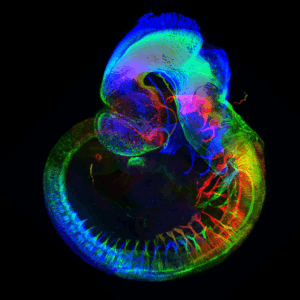 SVE; SFBD_Jordan-Allard_embryon-fded27afaf1d0c7b1d04b843bc858f9c