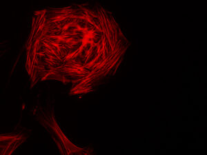 SVE; SNE_Ariane-Sharif_Rosace-cellulaire-f04541777400a386b0a6ab45fbb32db8