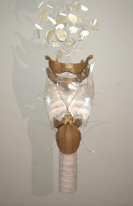 larynx-ca38a6a1064eca64b39186e1e39c377e