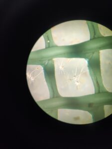 SVE; pentacrinoides-Tiphaine-Sancerni-Deshayes-LBDV-b86fc96350629f9c79bfb4066b7dbafd